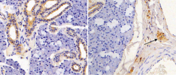 Positive staining using the HHV-7 KR4 antibody (brown) in salivary gland tissue (left) and peripheral nerve ganglia (right). Source: Journal of Virology