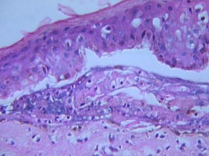 TEN liver case report graphic copy